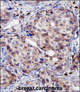 RNF144A Antibody (Center)