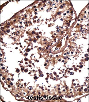 NANOS1 Antibody (Center)