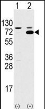 SWAP70 Antibody (Center)