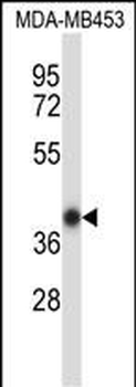Mouse Hoxc11 Antibody (N-term)