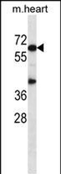 Mouse Akt1 Antibody (N-term)
