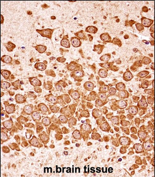 Mouse Dapk3 Antibody (Center)