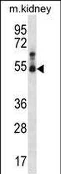 Mouse Stk32b Antibody (C-term)