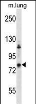 Mouse Adrbk2 Antibody (C-term)