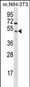 Mouse Gsk3a Antibody (C-term)