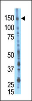 BIKE Antibody (Center)