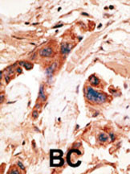 BIKE Antibody (Center)