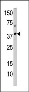 RCL1 Antibody (N-term)