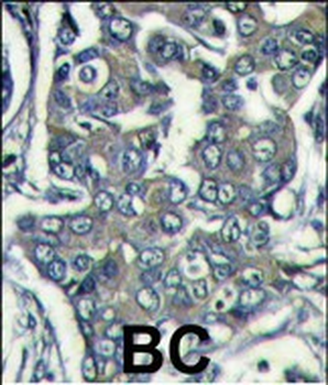 EIF4E2 Antibody (N-term)