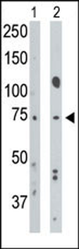 BMPR1A Antibody (N-term)