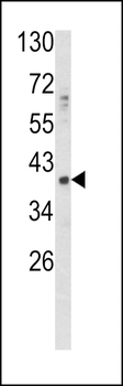 GDF1 Antibody (N-term)