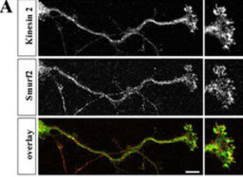 SMURF2 Antibody (C-term)