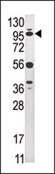 USP1 Antibody (C-term)
