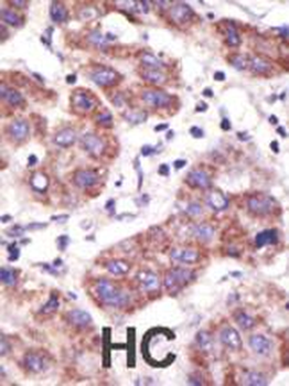 USP3 Antibody (N-term)