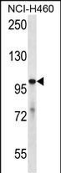 USP6 Antibody (C-term)
