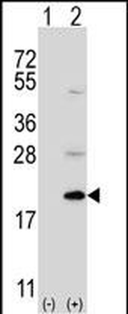 Ufc1 Antibody (C-term)