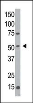MGAT1 Antibody (C-term)