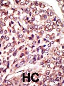 MGAT1 Antibody (C-term)