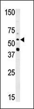 NMT2 Antibody (N-term)