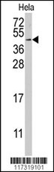RFC5 Antibody (Center R185)