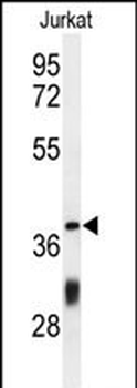 CC130 Antibody (Center)