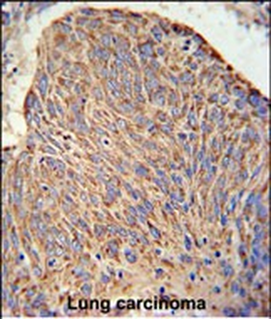 CC130 Antibody (Center)