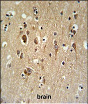 FA2H Antibody (Center)