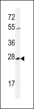 CWC15 Antibody (Center)
