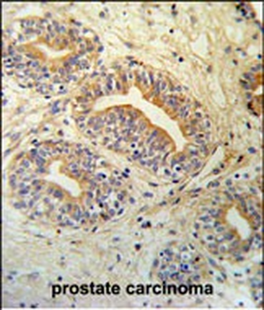 CWC15 Antibody (Center)