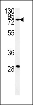ZFYVE16 Antibody (N-term)