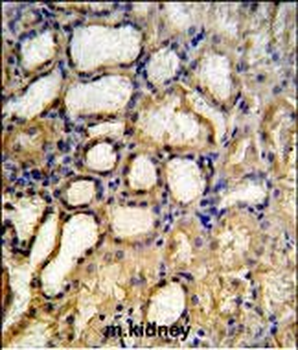 RT33 Antibody (C-term)
