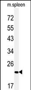 COPZ2 Antibody (C-term)