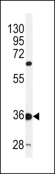 PIANP Antibody (N-term)