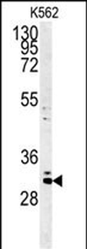C2orf49 Antibody (N-term)