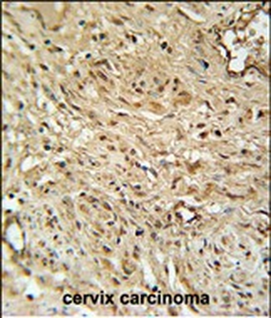 RPA43 Antibody (C-term)