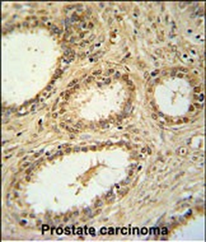 SNRNP40 Antibody (Center)