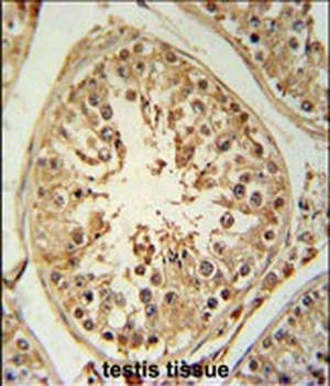 ZBTB5 Antibody (N-term)