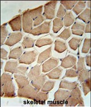 NPAL3 Antibody (N-term)