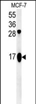 ATP5J2 Antibody (Center)