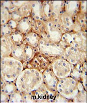 ATP5J2 Antibody (Center)