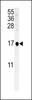 SIKE Antibody (C-term)