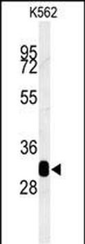 RDH16 Antibody (N-term)