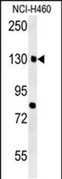 CTTB2 Antibody (N-term)