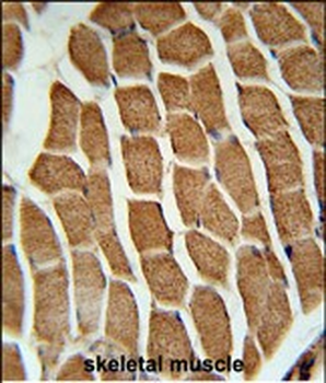 CTTB2 Antibody (N-term)