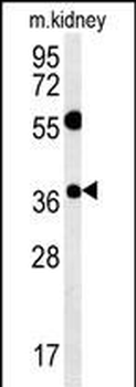 TSPAN3 Antibody (Center)