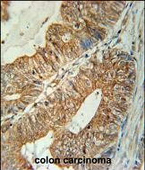 TSPAN3 Antibody (Center)