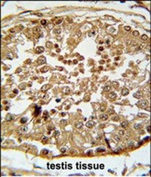 SPAG1 Antibody (N-term)