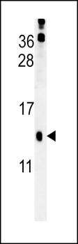 HRASLS3 Antibody (C-term)