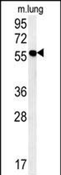 ZMYND10 Antibody (C-term)