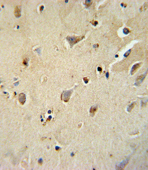 ATP1B1 Antibody (Center)